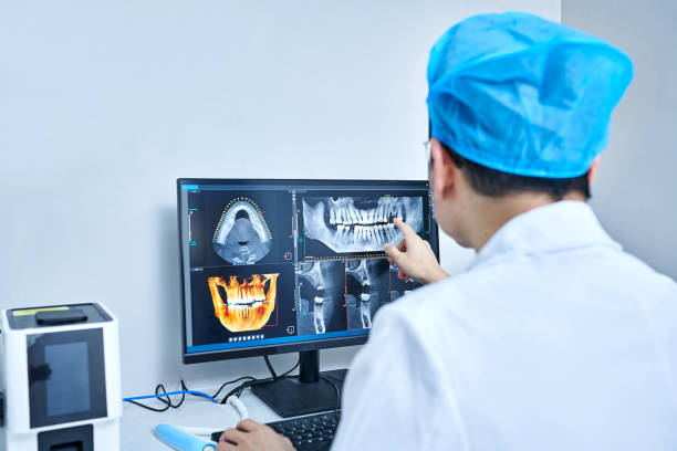 Best Emergency Wisdom Teeth Removal in West Branch, MI