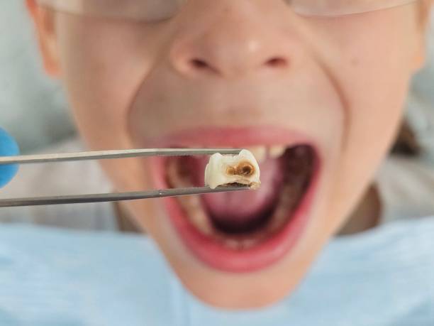 Best Emergency Broken Tooth Repair in West Branch, MI