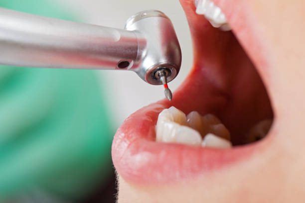 Best Pediatric Emergency Dentist in West Branch, MI